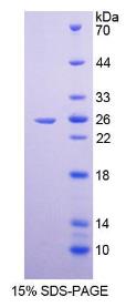 SDS-PAGE (TJP1-464H).jpg